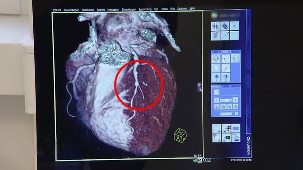 Achtung Notaufnahme! - Montag: Verdacht Auf Verengung Des Herzkranzgefäßes
